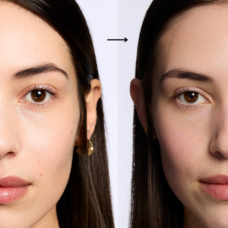 HOYGI Advanced Snail Peptide Pen